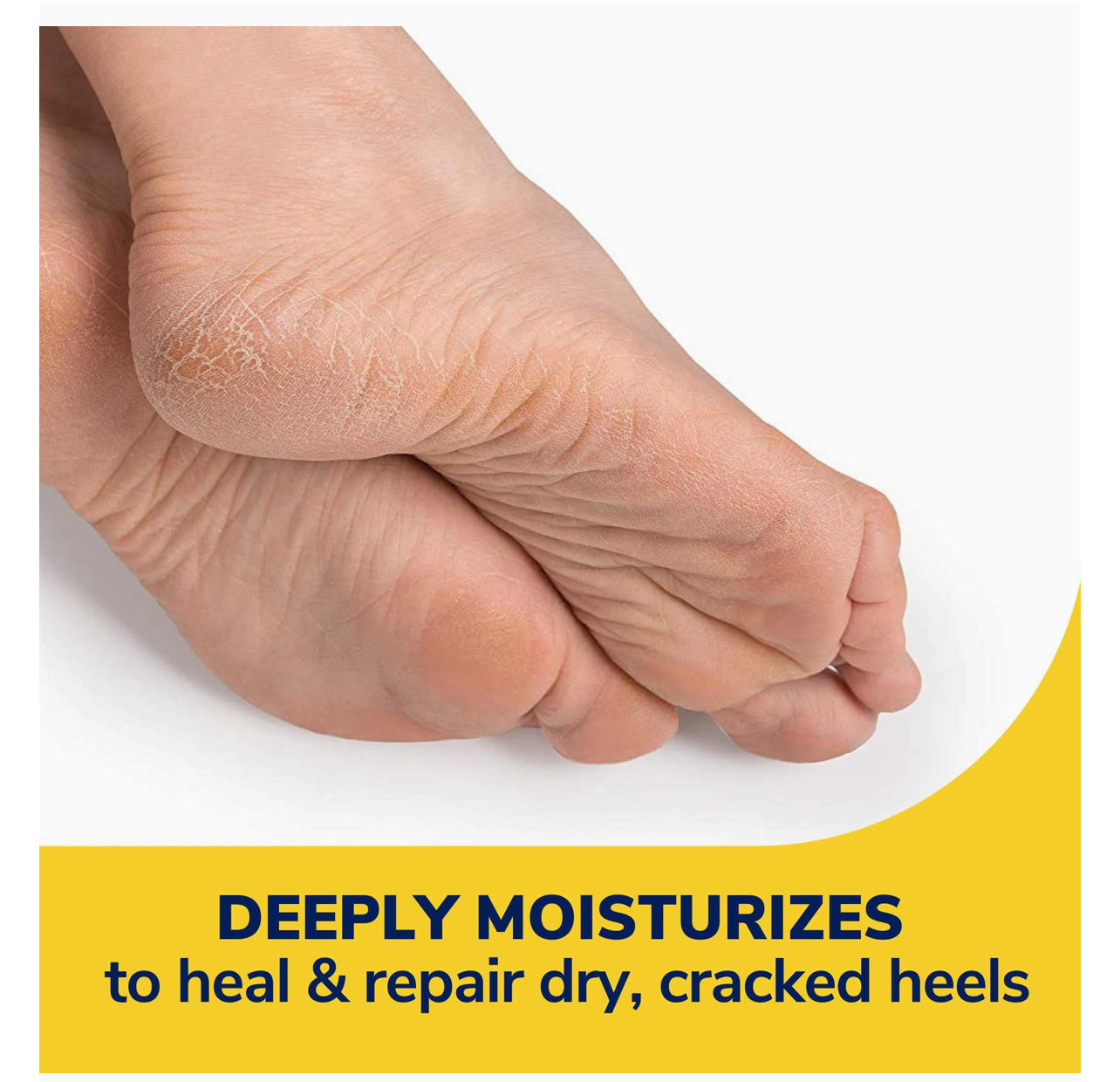 Balm for cracked heels